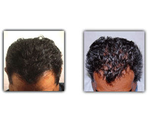 Power Grow Comb a 59,99€