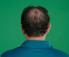 Hair Grow Max 2x1 a 248 LEU