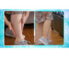 Veins Gone 2x1 a 202 LEU