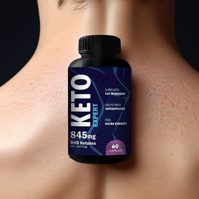 KetoExpert