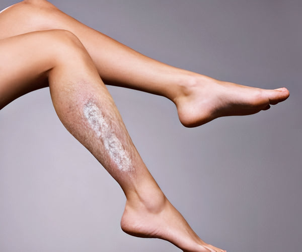 Hair Erase 2x1 por 59,99€