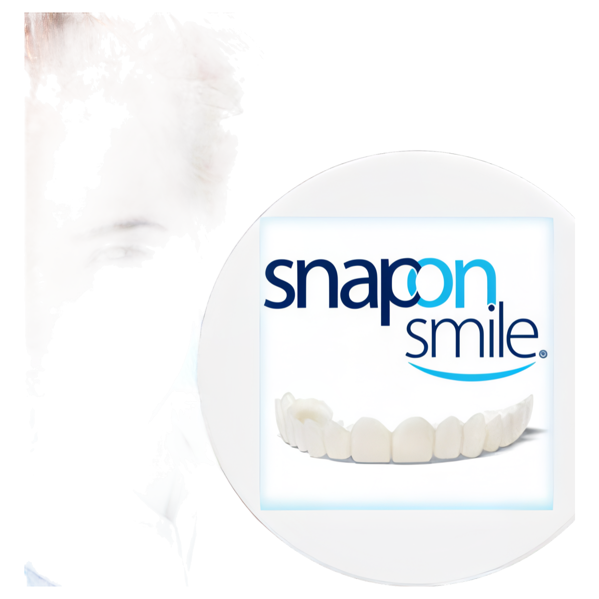 Snap-On Smile